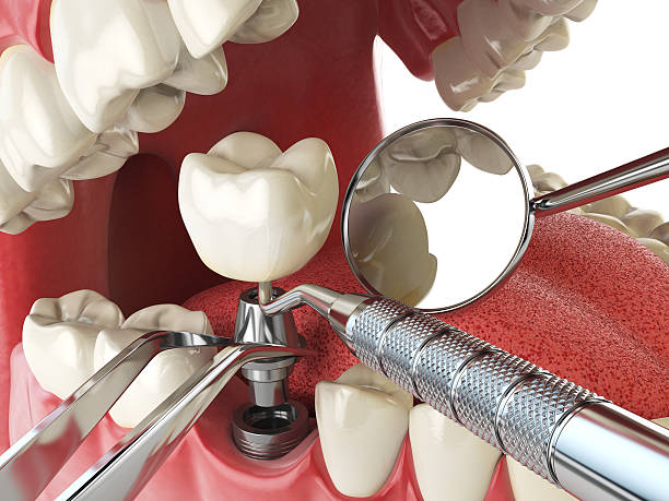 Best Mobile Emergency Dentist in Double Springs, AL